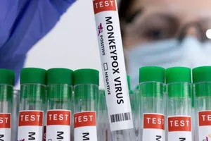 Các ống nghiệm có dán nhãn "dương tính với virus đậu mùa khỉ".