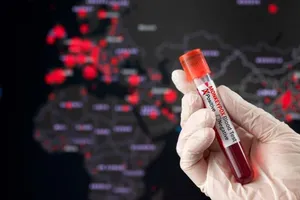 Một mẫu máu có kết quả xét nghiệm dương tính với virus đậu mùa khỉ.