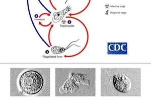 Con đường lây nhiễm của amip ăn não Naegleria folweri.