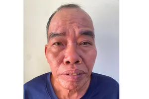 Hải Phòng: Tạm giữ người đàn ông đánh cảnh sát giao thông