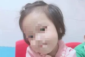 Bé 3 tuổi bị người tình của mẹ đóng đinh vào đầu đã tử vong