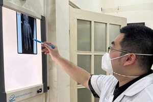 Nát bàn tay vì vừa chơi game vừa sạc pin điện thoại