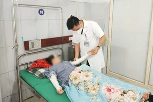 Nguy cơ bỏng mặt, mù mắt từ bóng bay trang trí phát nổ 