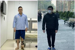 Kéo dài chân tới 18 cm cho chàng trai 23 tuổi 