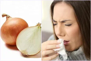 Chữa dứt điểm cảm, ho, sổ mũi chỉ với một củ hành tây 