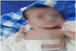 Bệnh viện nơi Tây Bắc xa xôi cứu thành công một trẻ sơ sinh có ruột nằm ngoài ổ bụng