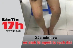 Bản tin 17h: Xác minh vụ nữ sinh bị người lạ rạch đùi