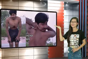 Vui độc lạ: ‘Dị nhân’ xoay ngược đầu, di chuyển dạ dày