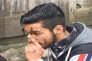 Rợn người cảnh dùng đỉa để trị liệu nhân dịp năm mới