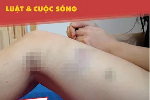 Chồng bị vợ tố đánh và ép quan hệ tình dục phạm tội gì?