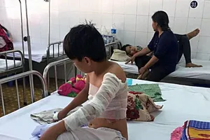 Cha phóng hỏa, 2 mẹ con nhập viện vì bỏng