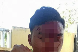 Cán bộ kiểm lâm bị 2 phụ nữ đánh gãy xương mũi