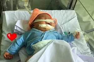 Hội chẩn toàn viện bé gái gãy tay, ngạt thở khi sinh