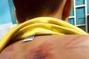 Bé trai 11 tuổi bị 1 người tu hành đánh dã man