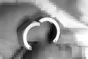 Giải cứu người đàn ông đeo vòng kim loại vào dương vật 