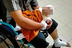 Truy tìm người ném bom xăng khiến bé trai 4 tháng tuổi bị bỏng nặng