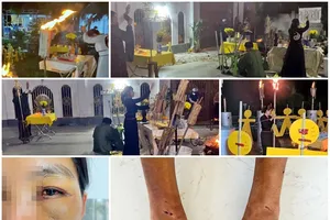 Công an điều tra một phụ nữ bị hành hạ dã man nghi do cuồng tín