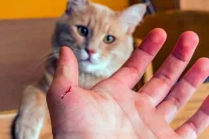 Tử vong sau khi bị mèo hoang cào vào bắp chân