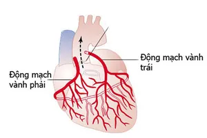 Cứu sống nhiều ca mạch vành cấp nặng cấp cứu