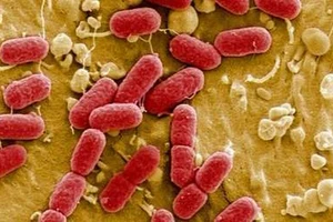 Hơn 100 công nhân bị ngộ độc: Nghi do nhiễm khuẩn E.coli