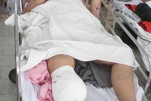 Vụ sập công trình tại Cần Thơ: Một nạn nhân bị cắt cụt chân