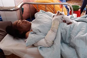 Mua xăng về cất, 2 mẹ con bị bỏng nguy kịch