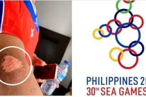 Cầu thủ Campuchia chấn thương hàng loạt vì mặt sân cỏ nhân tạo