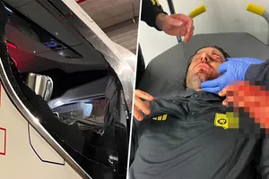 HLV Grosso của Lyon bị fan ném đá, máu đầm đìa