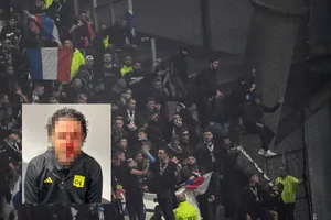 HLV Grosso đổ máu, 9 CĐV bị bắt sau bạo loạn gây rúng động bóng đá Pháp