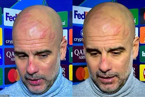Pep Guardiola xuất hiện với nhiều vết thương gây chấn động: ‘Tôi muốn tự làm mình bị thương’