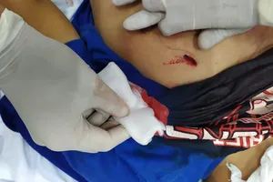 Bí ẩn người phụ nữ đưa nạn nhân bị đâm thấu ngực vào viện 