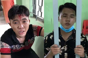 Kẻ trộm xe rút dao tấn công Cảnh sát hình sự Thủ Đức bị thương