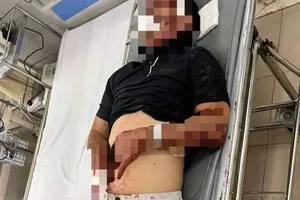 Bị đánh đa chấn thương nghi do mâu thuẫn với nữ nhân viên quán karaoke 