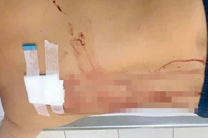 Nhân viên quán cà phê ở Nha Trang bị truy sát bằng súng