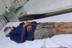 Con rể chém 2 người nhà vợ trọng thương 