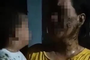 Vụ đổ phân lên người bé 2 tuổi: Lãnh đạo xã hời hợt