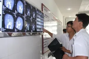 Cứu sống bệnh nhân bị đột quỵ não, liệt toàn thân