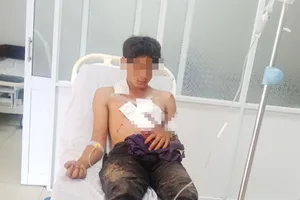 Đi đánh cá, 2 thanh niên bị thương nặng do mìn tự chế phát nổ