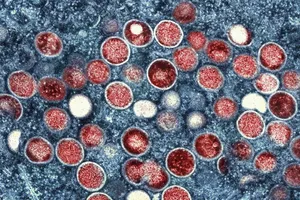 Hình ảnh hiển vi điện tử của virus “đậu mùa khỉ” hay “mpox”. Ảnh: AP