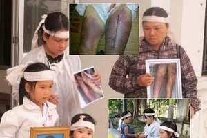 Ai giúp dân chứng minh đã bị công an đánh?