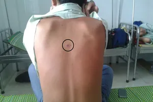 Trưởng công an xã bị tố bắn, đánh dân nhập viện