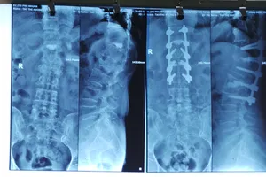 Ca bệnh chuyên gia Mỹ 'nhát tay', Việt Nam mổ thành công