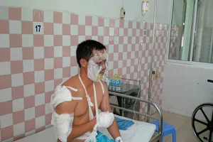 Cháy nổ lớn trong kho hóa chất, 17 chiến sĩ PCCC bị thương