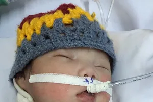 Bệnh nhi vừa chào đời phải mổ cắt khối u khổng lồ