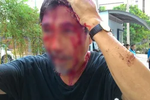 Lời kể của cư dân chung cư 4S bị đánh chấn động não