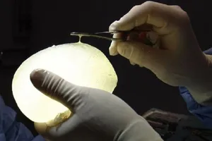 Trả 64 triệu USD cho 20.000 phụ nữ nâng ngực bị lỗi