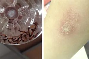 Kiến 3 khoang cực độc tấn công trong mùa thi