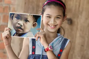 Tiến Phước Group giúp gần 60 trẻ hở hàm ếch tìm lại nụ cười trọn vẹn