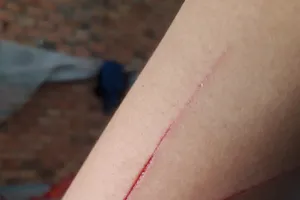 Vụ tuổi 14 giám định thành 17: Lời khai bất ngờ của bé gái