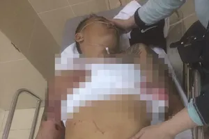 Truy bắt nhóm thanh niên bịt mặt, nổ súng vào quán cà phê 